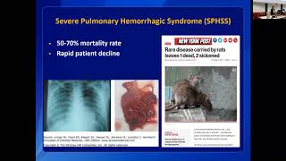 Leptospirosis Clinical Disease and Diagnosis in Humans [upl. by Berger]