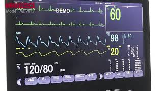 How to connect a Patient monitor to Central Monitoring System [upl. by Strauss]