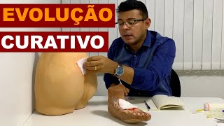 Evolução  Curativo [upl. by Merola]