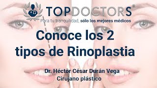 Conoce los 2 tipos de Rinoplastia [upl. by Ojytteb]