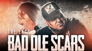 The Lacs Bad Ole Scars Official Music Video [upl. by Keel210]