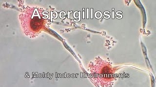 Aspergillosis amp Moldy Indoor Environments [upl. by Lucinda]