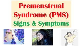 Common Symptoms and Signs of an Upcoming Period [upl. by Shelbi]