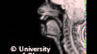 MRI voiceless postalveolar fricative [upl. by Anerroc]